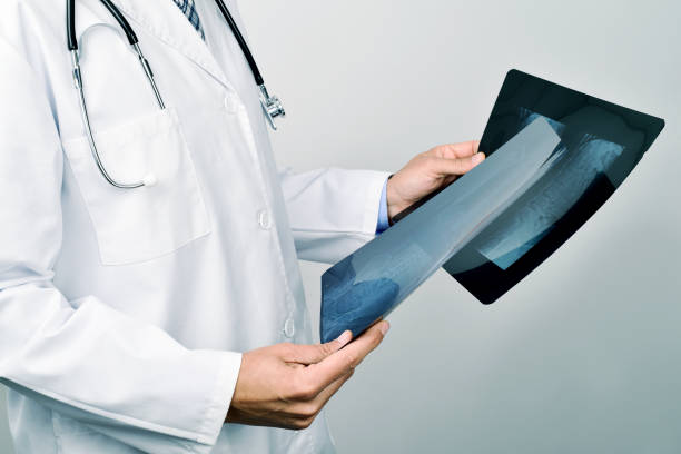 closeup of a young caucasian doctor man observing some radiographs